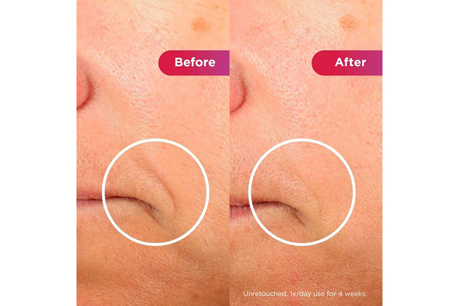 Shark Cryoglow LED Anti-ageing & Blemish Repair Mask | FW312UK