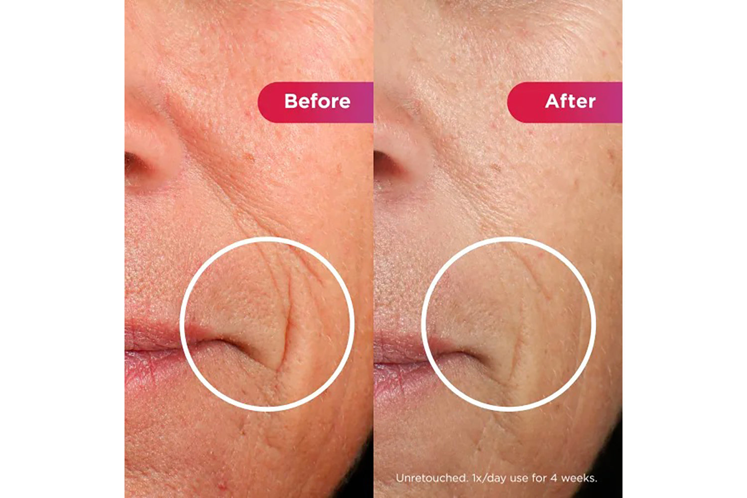 Shark Cryoglow LED Anti-ageing & Blemish Repair Mask | FW312UK