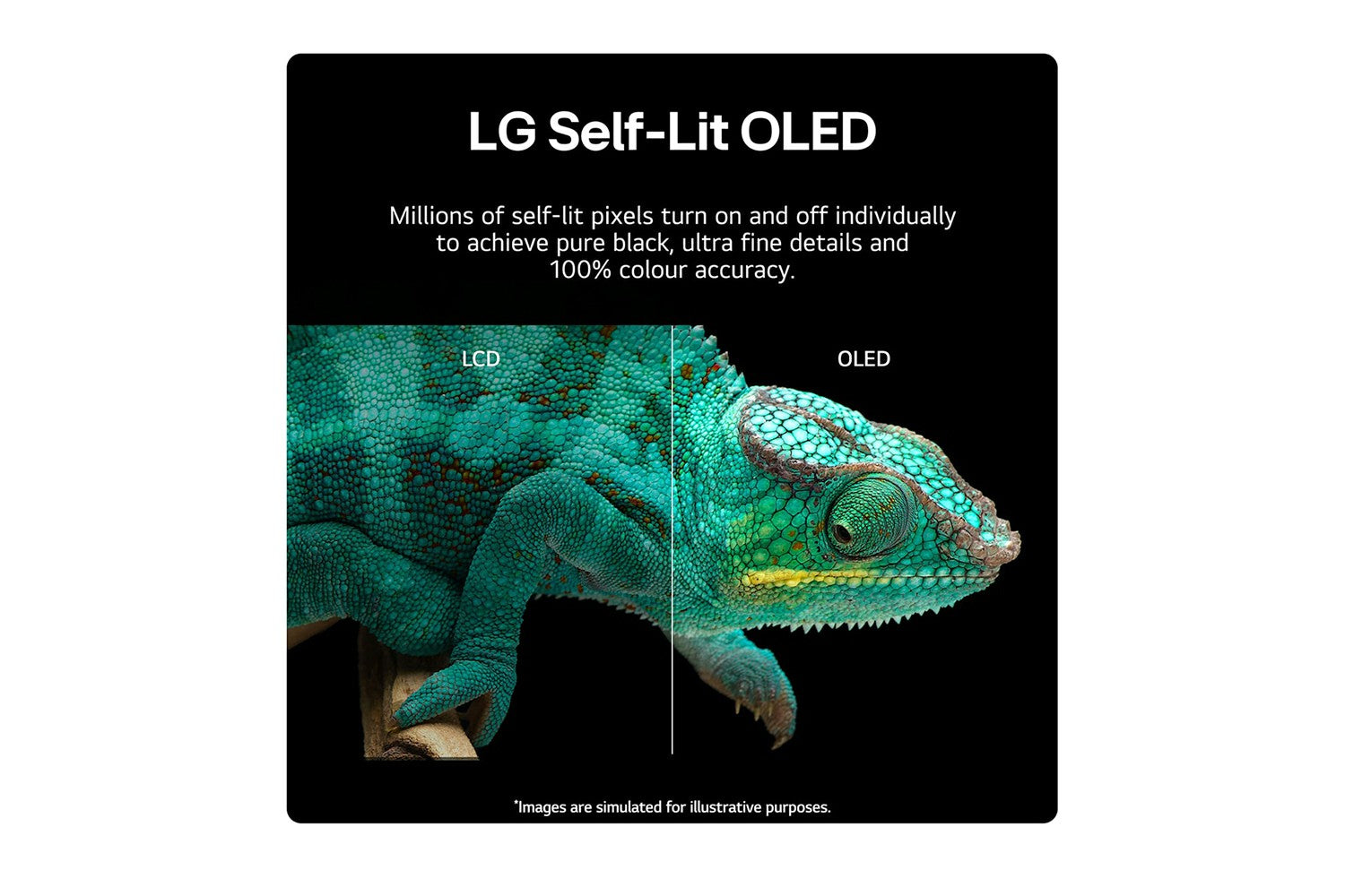 LG 65